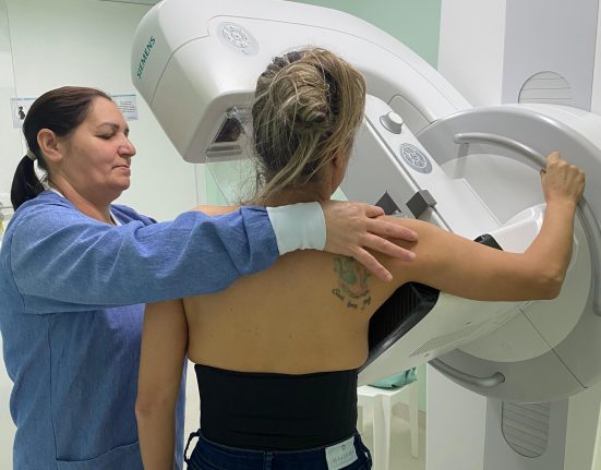 Hospital de Xanxerê agiliza a realização de 263 mamografias